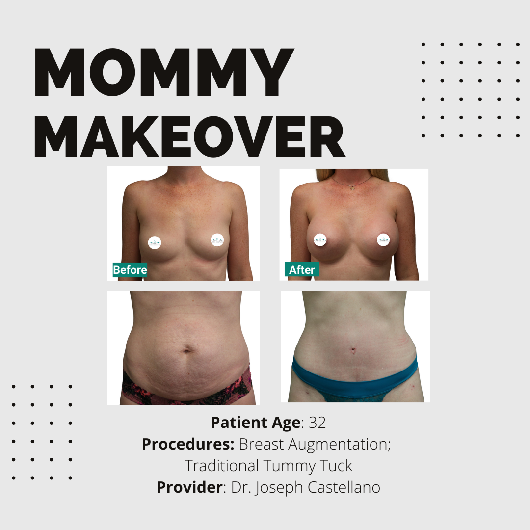 Mommy Makeover (Virtual Consult)